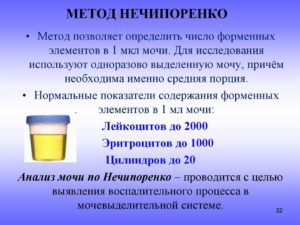 Алгоритм моча по нечипоренко