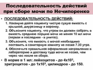 Алгоритм моча по нечипоренко