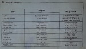 Анализ мочи с похмелья