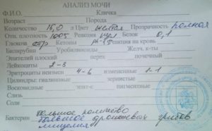 Анализ мочи с похмелья