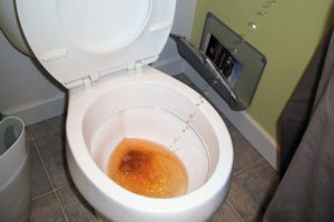 Больно писать женщине и кровь в моче