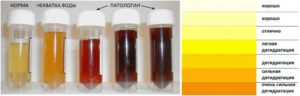 Цвет мочи при цистите у женщин