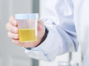 Цвет мочи при цистите у женщин