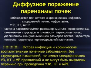 Диффузно неоднородные изменения структуры синусов обеих почек