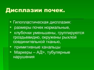 Дисплазия почек классификация