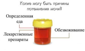 Фуразолидон окрашивает мочу в желтый цвет