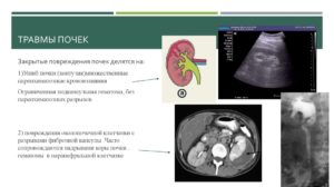 Гематома в почке лечение