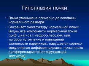 Гипоплазия почки причины