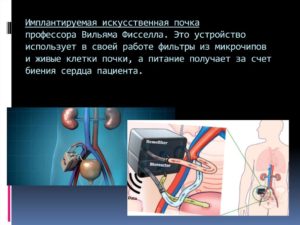 Имплантируемая искусственная почка 2016