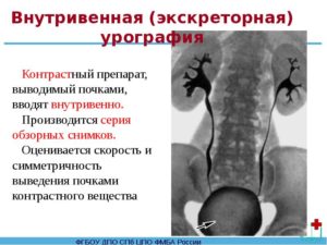 Как называется контрастное вещество для почек