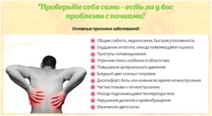 Как понять болит почка или спина