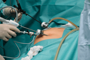 Как проходит операция на почках