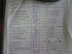 Какие анализы сдать при пиелонефрите и цистите