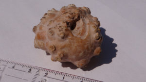 Камни в почках из за курения