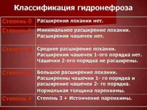Классификация гидронефроза по степени