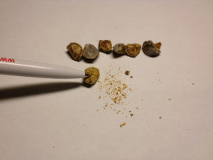 Когда выходит песок с почек симптомы