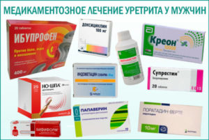 Лечение аллергического уретрита