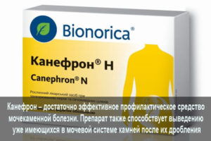 Медикаментозное лечение при мочекаменной болезни