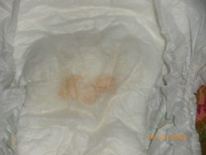 Моча новорожденного пахнет