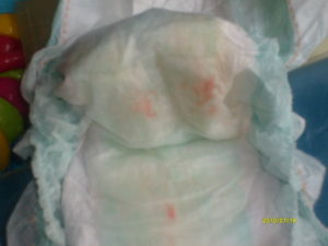 Моча новорожденного пахнет