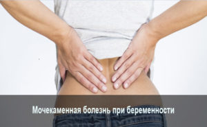 Мочекаменная болезнь при беременности последствия для ребенка