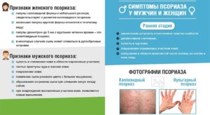 Можно ли получить инвалидность при псориазе и гломерулонефрит