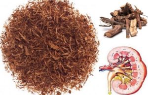 Песок из почек выходит болезненно