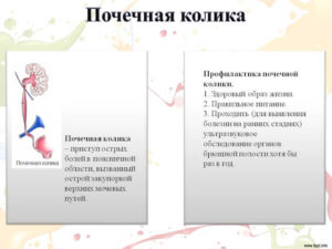 Почечные колики симптомы у мужчин симптомы лечение