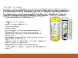 Повышенный белок в моче у мужчин
