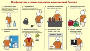 Профилактика и лечение мочекаменной болезни у мужчин