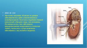 Рак почки мкб