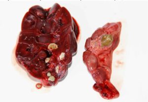 Реально ли растворить камни в почках