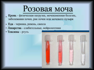 Розовая моча причины