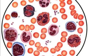 В мазке лейкоциты и эритроциты