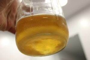 В моче крупинки оранжевые