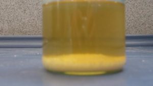 В моче крупинки оранжевые