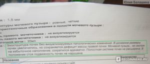 Сколько воды нужно пить перед узи почек и мочевого