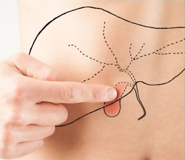 удаления желчного пузыря