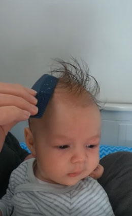 Мама убирает корочки с головы ребенка