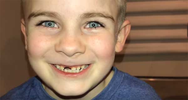У мальчика выпал первый зуб