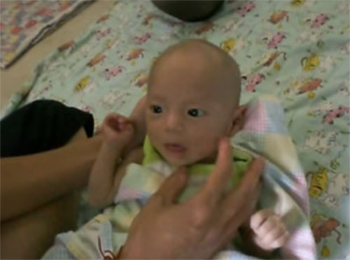 Очень худой ребенок