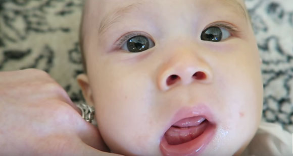 Напухшие десна ребенка