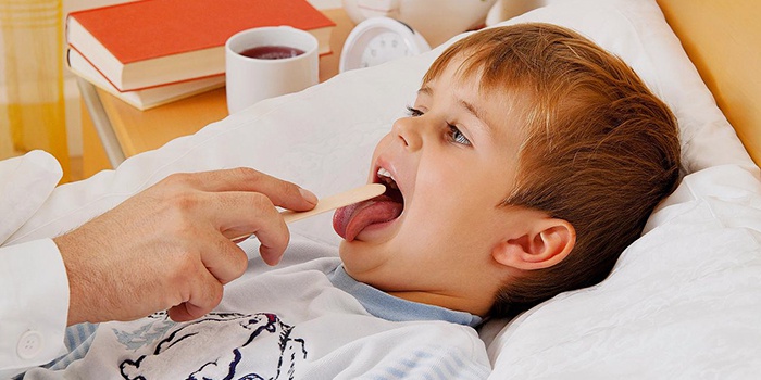 Лечение ангины