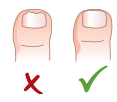 Правильно подстригаем ногти ребенку