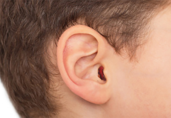 Кровь из уха ребенка