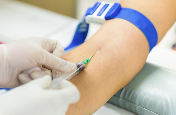 Взятие крови с вены