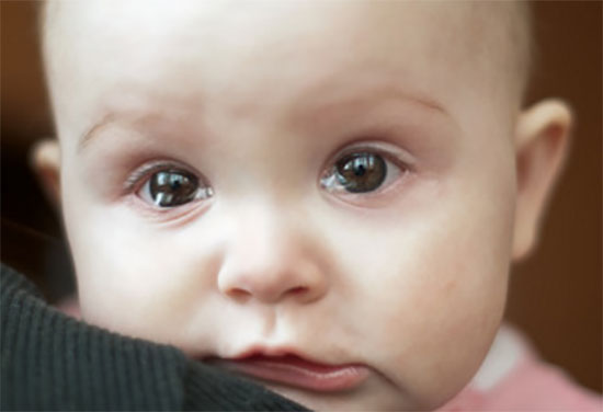 Грудничок со слезящимися глазами