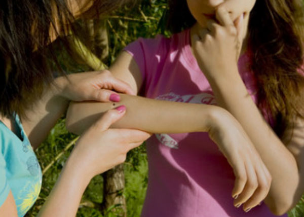 Женщина заметила на руке дочки клеща