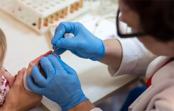 Ребенку делают общий анализ крови