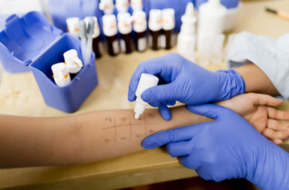 Аллергопробы